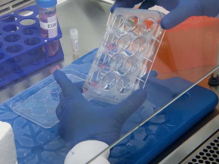 The Aortic Ring Co-culture Assay: A Convenient Tool to Assess the Angiogenic Potential of Mesenchymal Stromal Cells In Vitro