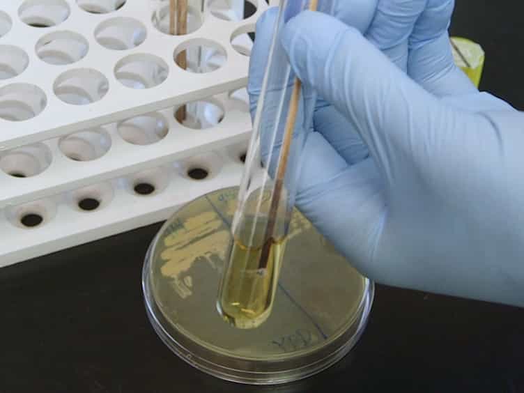 Measuring mRNA Levels Over Time During the Yeast S. cerevisiae Hypoxic Response