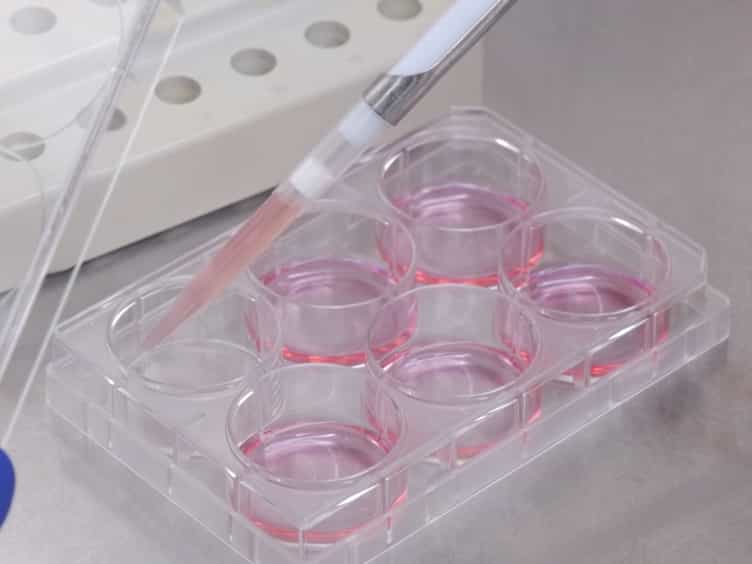 Efficient Generation and Editing of Feeder-free IPSCs from Human Pancreatic Cells Using the CRISPR-Cas9 System