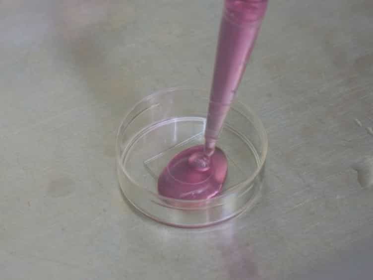 In Vitro and In Vivo Detection of Mitophagy in Human Cells, C. Elegans, and Mice
