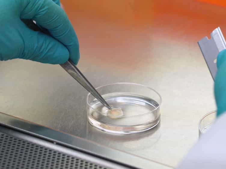 Corneal Tissue Engineering: An In Vitro Model of the Stromal-nerve Interactions of the Human Cornea