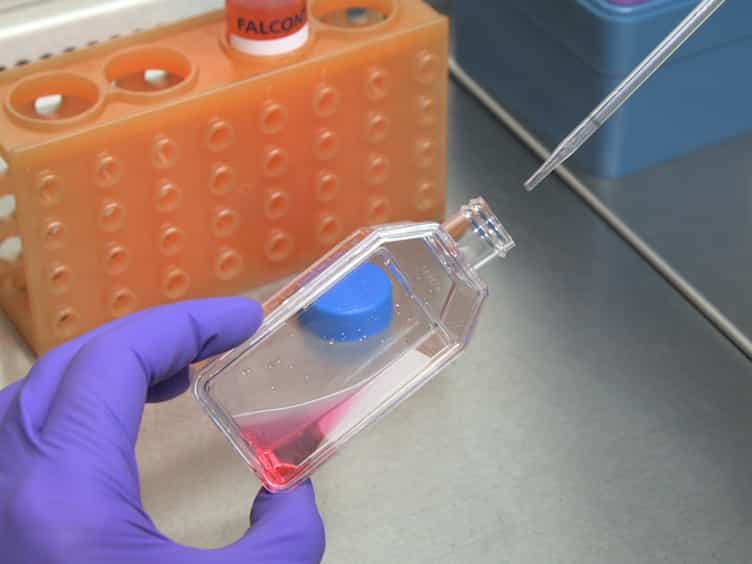 Evaluation of the Cell Invasion and Migration Process: A Comparison of the Video Microscope-based Scratch Wound Assay and the Boyden Chamber Assay