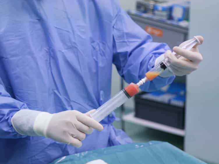 Autologous Microfractured and Purified Adipose Tissue for Arthroscopic Management of Osteochondral Lesions of the Talus
