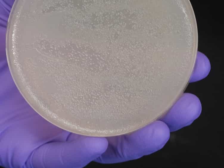 Assessment of Dictyostelium discoideum Response to Acute Mechanical Stimulation