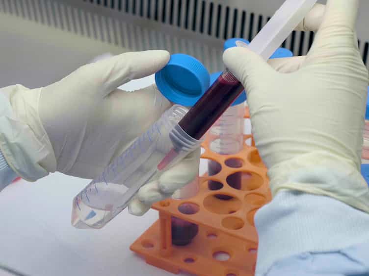 Megakaryocyte Differentiation and Platelet Formation from Human Cord Blood-derived CD34+ Cells