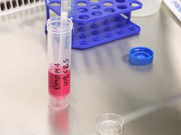 Moving Upwards: A Simple and Flexible In Vitro Three-dimensional Invasion Assay Protocol