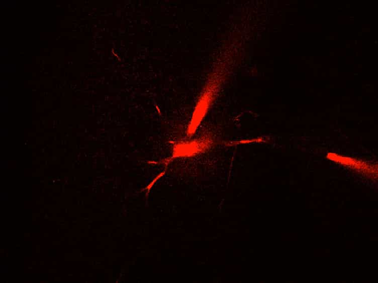 Two-photon Calcium Imaging in Neuronal Dendrites in Brain Slices