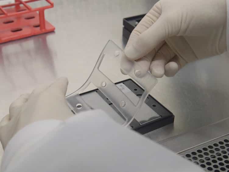 Zika Virus Specific Diagnostic Epitope Discovery