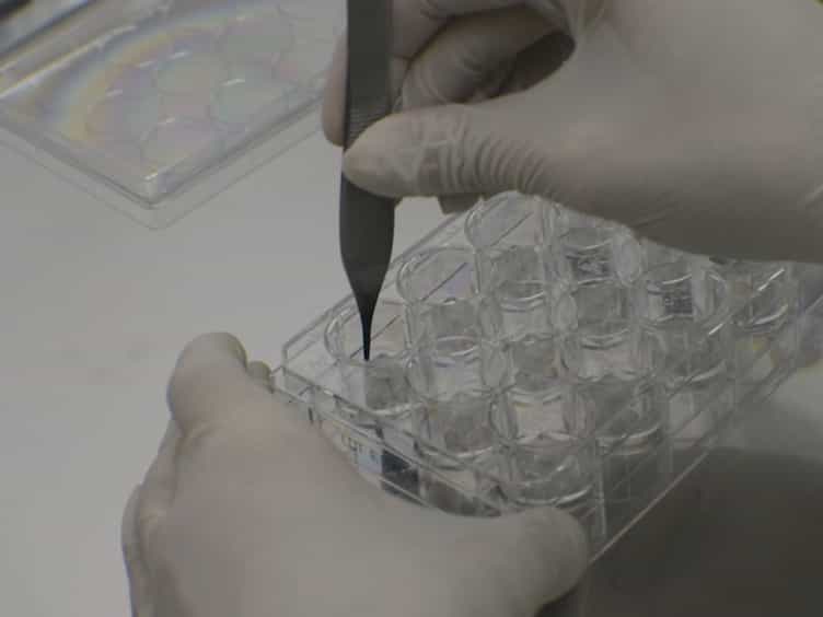 A Novel In Vitro Wound Healing Assay to Evaluate Cell Migration