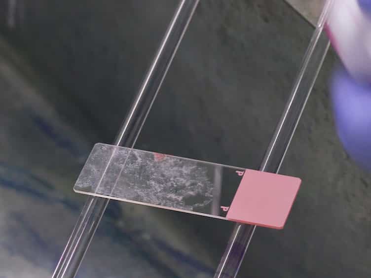 Simple and Rapid Method to Obtain High-quality Tumor DNA from Clinical-pathological Specimens Using Touch Imprint Cytology