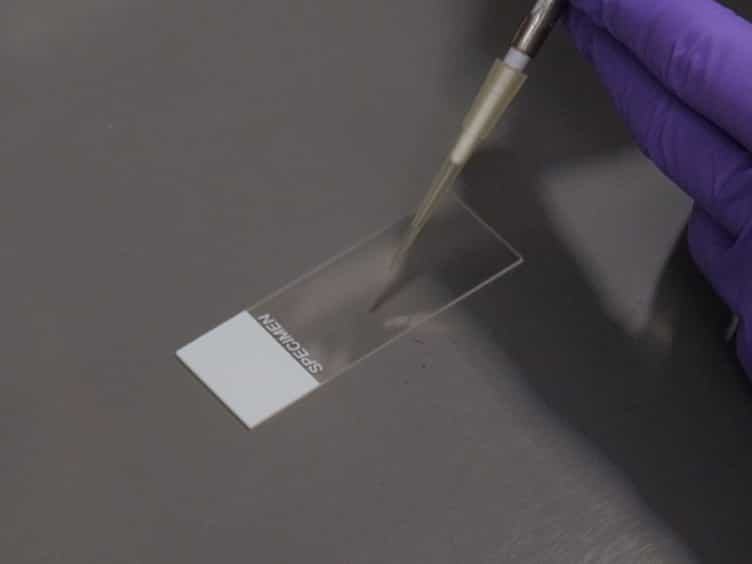 Automated Measurement of Cryptococcal Species Polysaccharide Capsule and Cell Body
