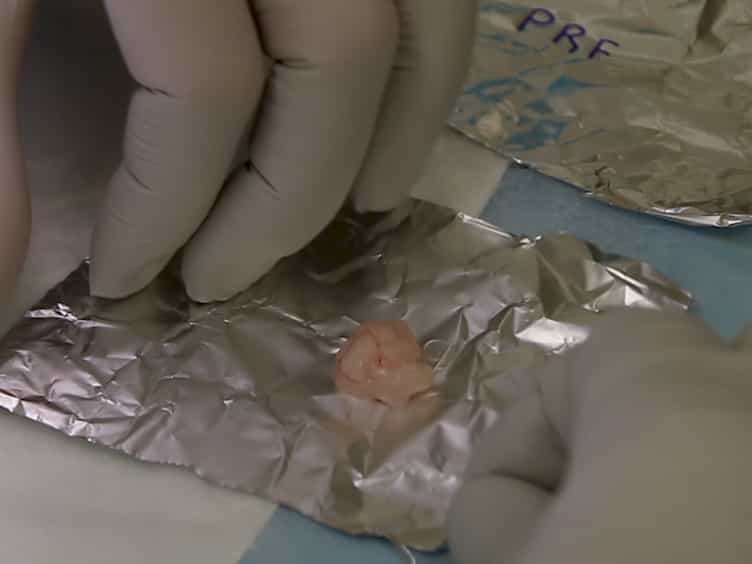 Mouse Adipose Tissue Collection and Processing for RNA Analysis