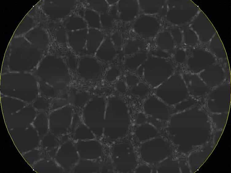 Kinetic Analysis of Vasculogenesis Quantifies Dynamics of Vasculogenesis and Angiogenesis In Vitro