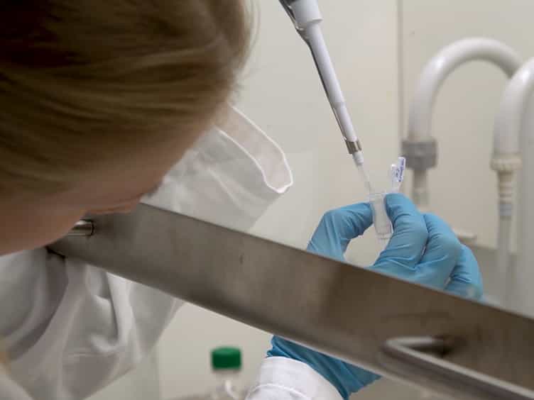 Investigation of RNA Synthesis Using 5-Bromouridine Labelling and Immunoprecipitation