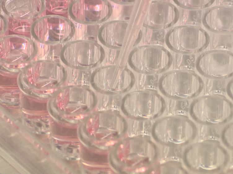 Visualization and Quantification of Mesenchymal Cell Adipogenic Differentiation Potential with a Lineage Specific Marker