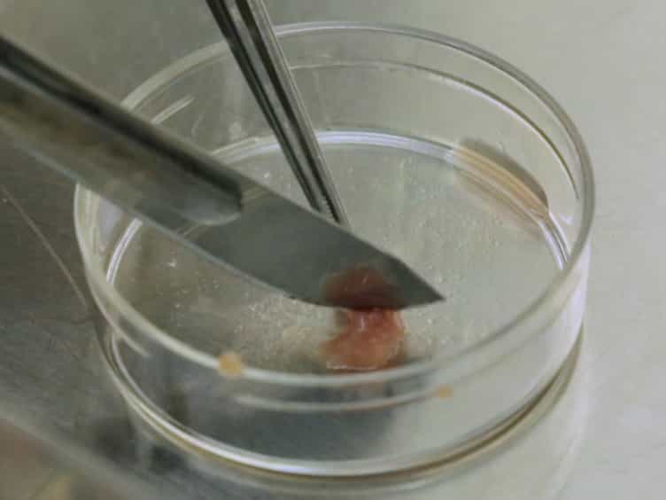 Isolation of Mesenchymal Stem Cells from Human Alveolar Periosteum and Effects of Vitamin D on Osteogenic Activity of Periosteum-derived Cells