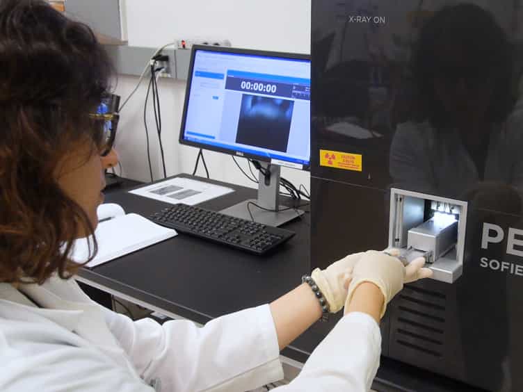 Utilizing 18F-FDG PET/CT Imaging and Quantitative Histology to Measure Dynamic Changes in the Glucose Metabolism in Mouse Models of Lung Cancer