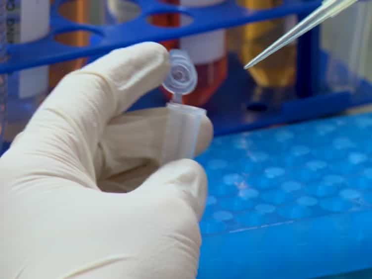 A Comprehensive Procedure to Evaluate the In Vitro Performance of the Putative Hemangioblastoma Neovascularization Using the Spheroid Sprouting Assay