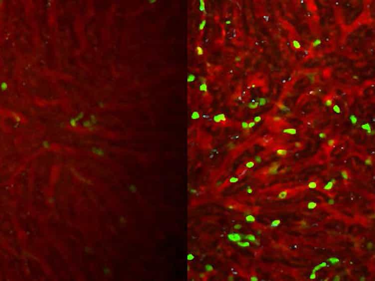 Two-photon Intravital Imaging of Leukocytes During the Immune Response in Lipopolysaccharide-treated Mouse Liver