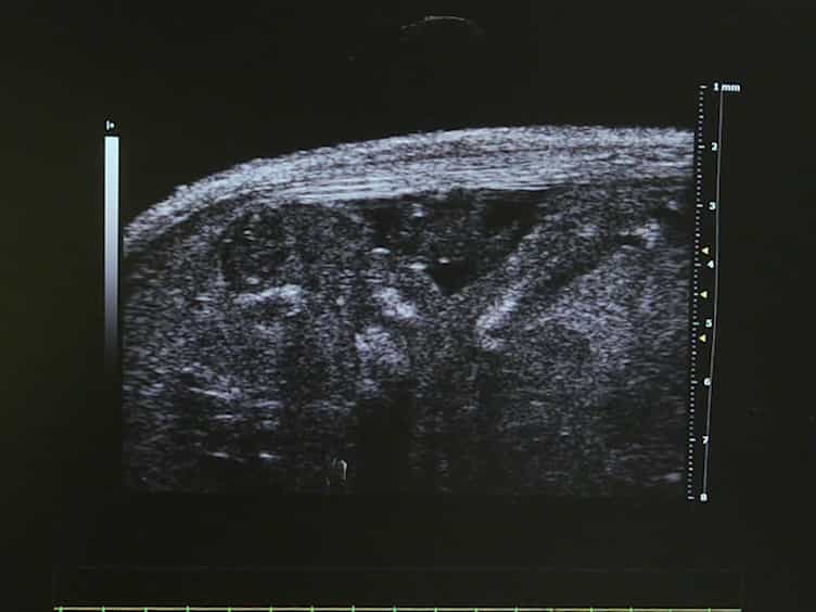 Fetal Mouse Cardiovascular Imaging Using a High-frequency Ultrasound (30/45MHZ) System