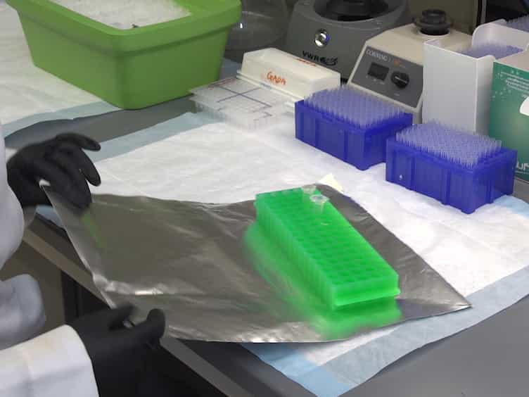 Electrochemiluminescence Assays for Human Islet Autoantibodies