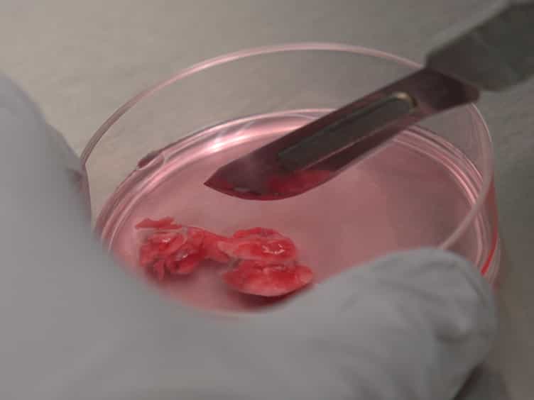 Isolation and In Vitro Culture of Murine and Human Alveolar Macrophages
