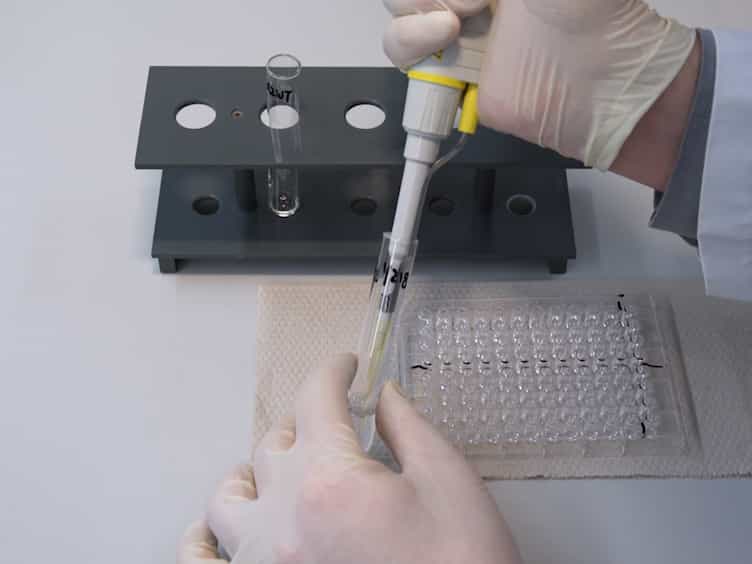 Titration ELISA as a Method to Determine the Dissociation Constant of Receptor Ligand Interaction