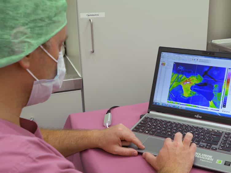 Assessment of Plasma Coagulation on Liver Tissue in a Large Animal Model In Vivo