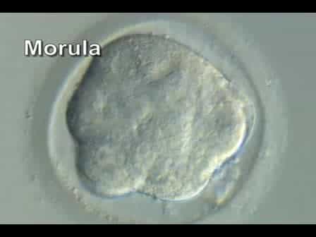 Derivation of Human Embryonic Stem Cells by Immunosurgery