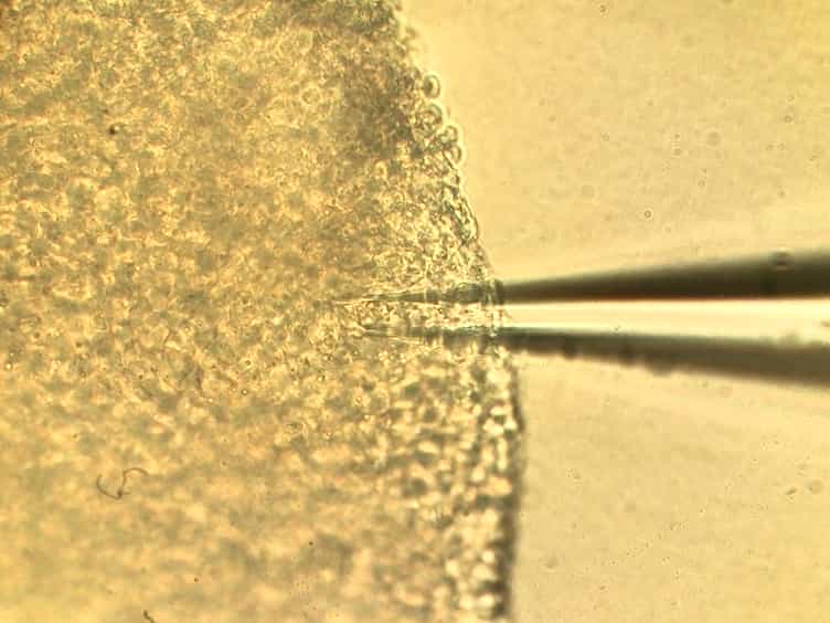 Preparations and Protocols for Whole Cell Patch Clamp Recording of Xenopus laevis Tectal Neurons