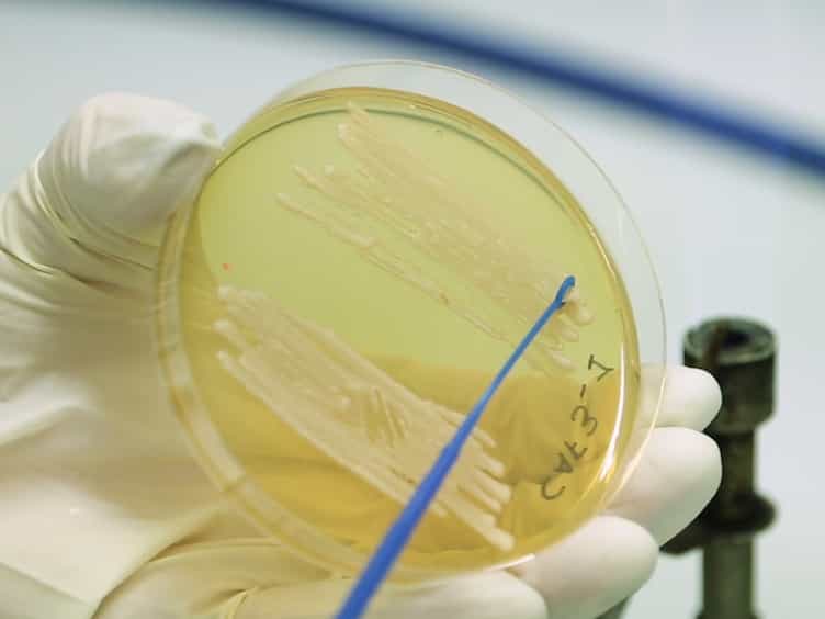 Deep Dermal Injection As a Model of Candida albicans Skin Infection for Histological Analyses