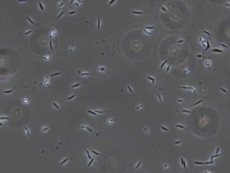 Polysome Profiling in Leishmania, Human Cells and Mouse Testis