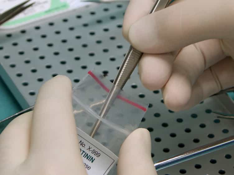 Induction of Nephrotic Syndrome in Mice by Retrobulbar Injection of Doxorubicin and Prevention of Volume Retention by Sustained Release Aprotinin