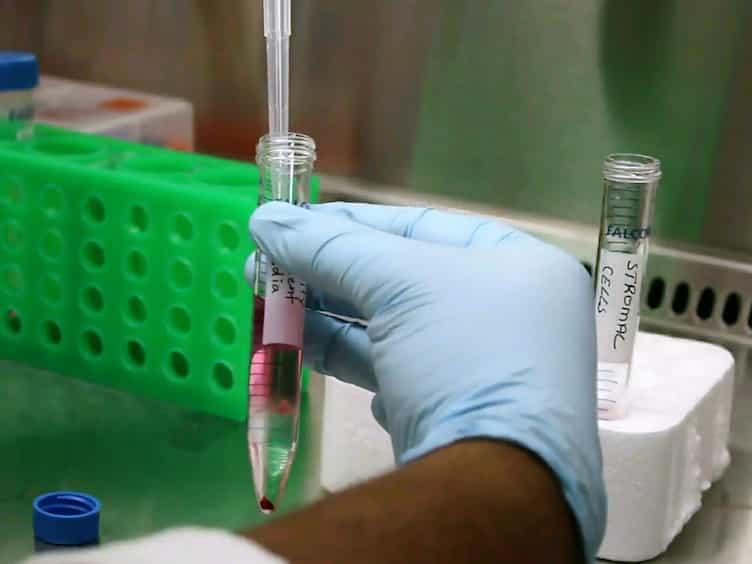 Isolation of Human Endometrial Stromal Cells for In Vitro Decidualization