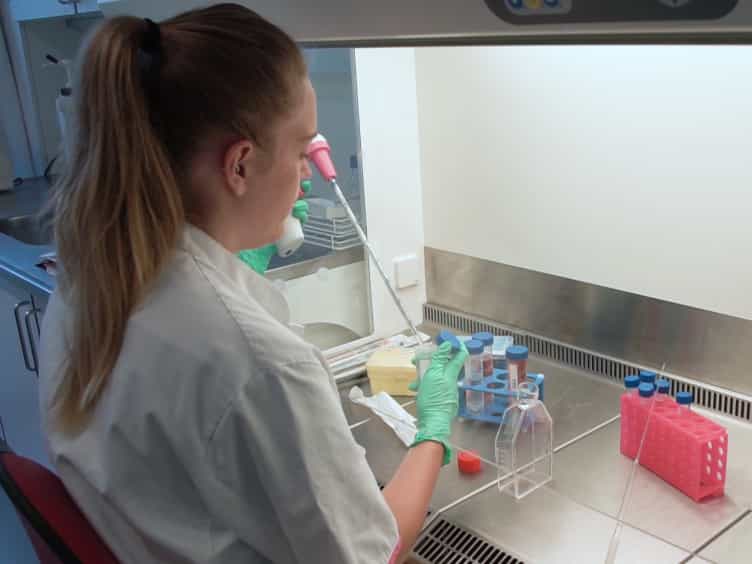 Optimized Scratch Assay for In Vitro Testing of Cell Migration with an Automated Optical Camera