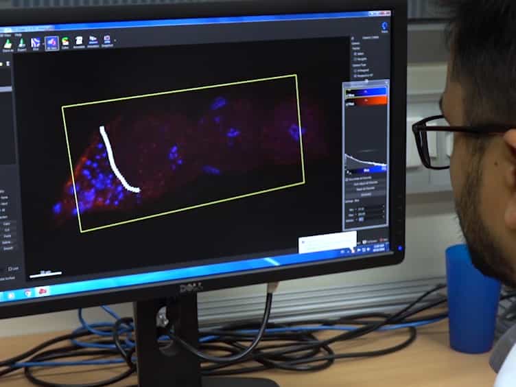 Computational Analysis of the Caenorhabditis elegans Germline to Study the Distribution of Nuclei, Proteins, and the Cytoskeleton