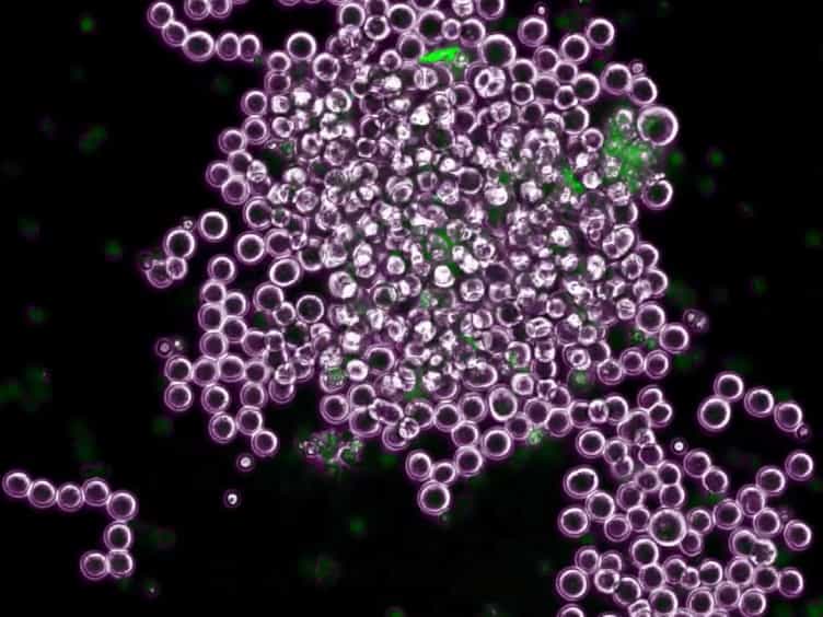 Neutrophil Extracellular Traps Generated by Low Density Neutrophils Obtained from Peritoneal Lavage Fluid Mediate Tumor Cell Growth and Attachment