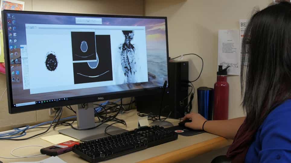 Whole Body and Regional Quantification of Active Human Brown Adipose Tissue Using 18F-FDG PET/CT