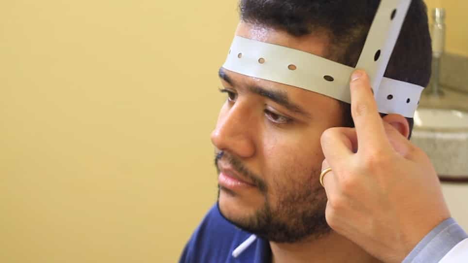 The Combined Use of Transcranial Direct Current Stimulation and Robotic Therapy for the Upper Limb