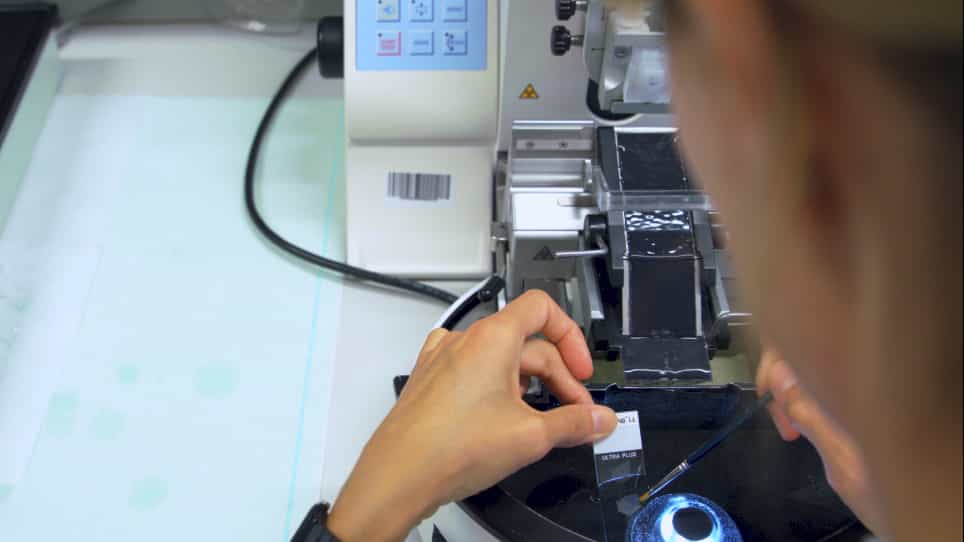 Establishment and Analysis of Tumor Slice Explants As a Prerequisite for Diagnostic Testing