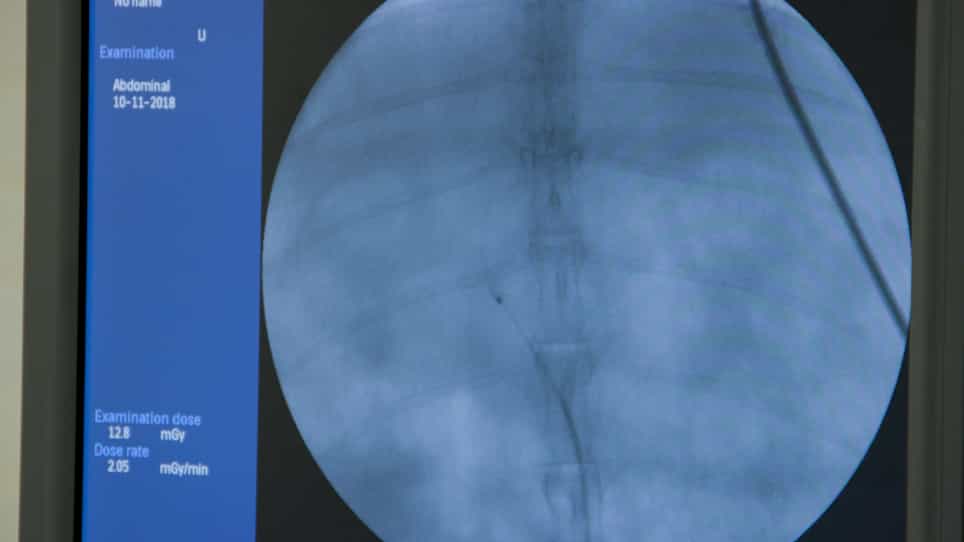 Development and Angiographic Use of the Rabbit VX2 Model for Liver Cancer
