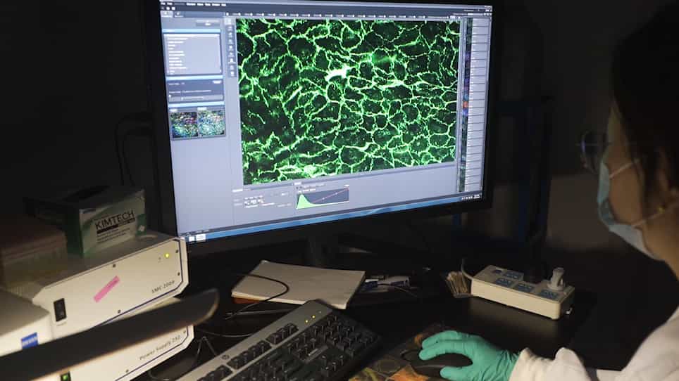 Using En Face Immunofluorescence Staining to Observe Vascular Endothelial Cells Directly