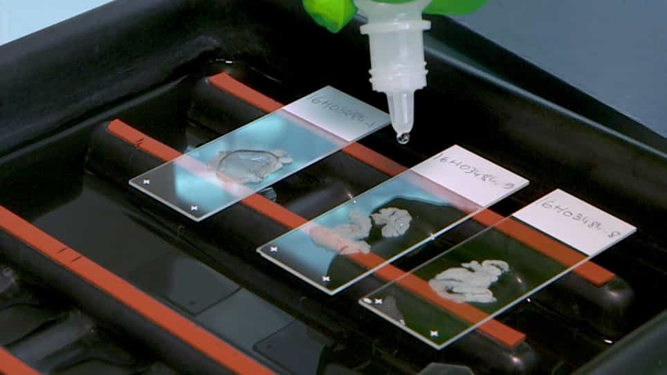 Chromogenic In Situ Hybridization as a Tool for HPV-Related Head and Neck Cancer Diagnosis
