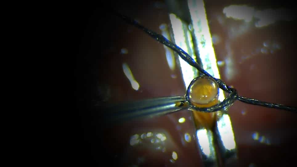Murine Cervical Aortic Transplantation Model using a Modified Non-Suture Cuff Technique