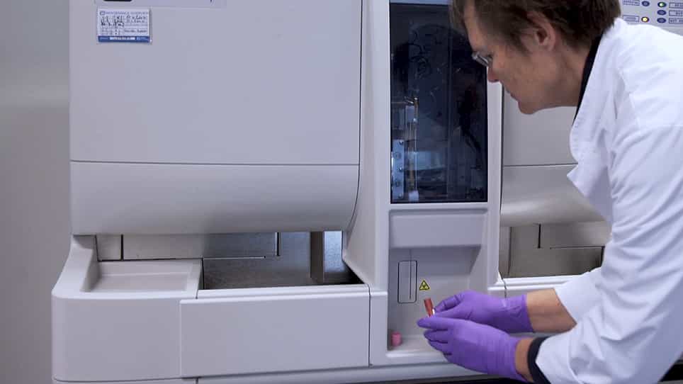 Characterization of Sickling During Controlled Automated Deoxygenation with Oxygen Gradient Ektacytometry
