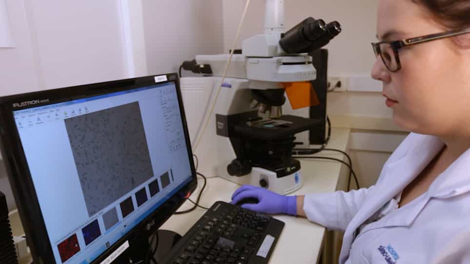 Quantification of Tumor Cell Adhesion in Lymph Node Cryosections