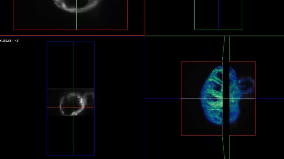 Displacement Analysis of Myocardial Mechanical Deformation DIAMOND Reveals Segmental Heterogeneity of Cardiac Function in Embryonic Zebrafish