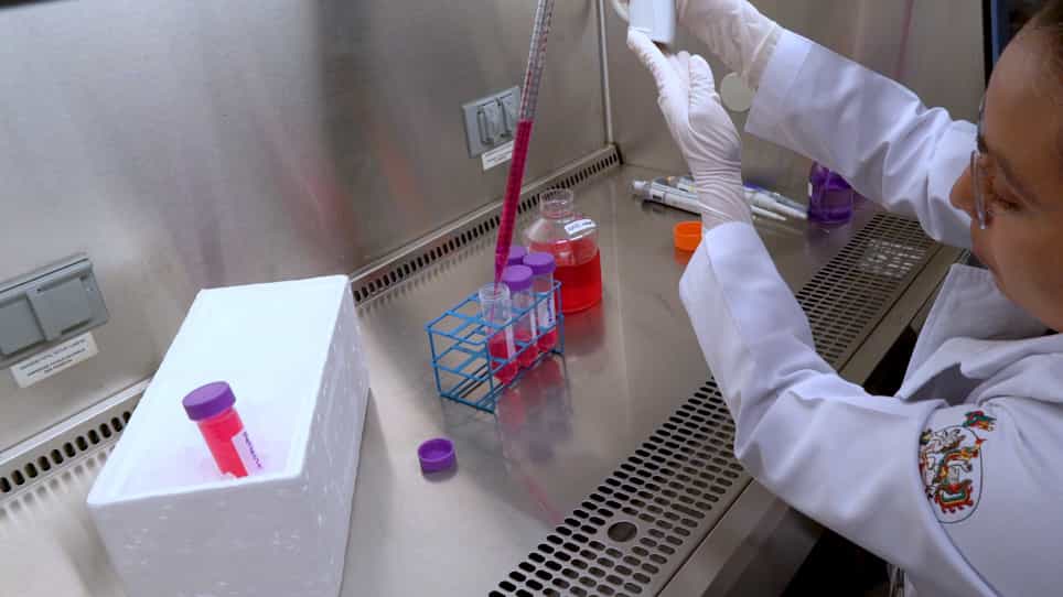 In Vitro Culture of Epithelial Cells from Different Anatomical Regions of the Human Amniotic Membrane