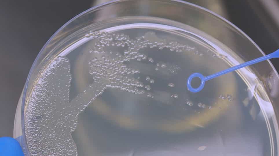 P. aeruginosa Infected 3D Co-Culture of Bronchial Epithelial Cells and Macrophages at Air-Liquid Interface for Preclinical Evaluation of Anti-Infectives