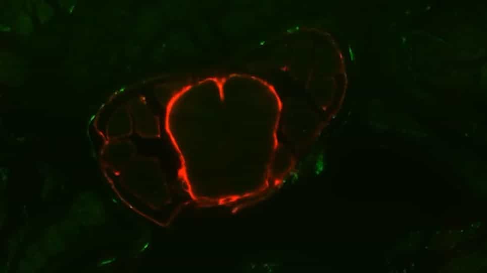 Three-Dimensional Imaging of the Vertebral Lymphatic Vasculature and Drainage using iDISCO+ and Light Sheet Fluorescence Microscopy